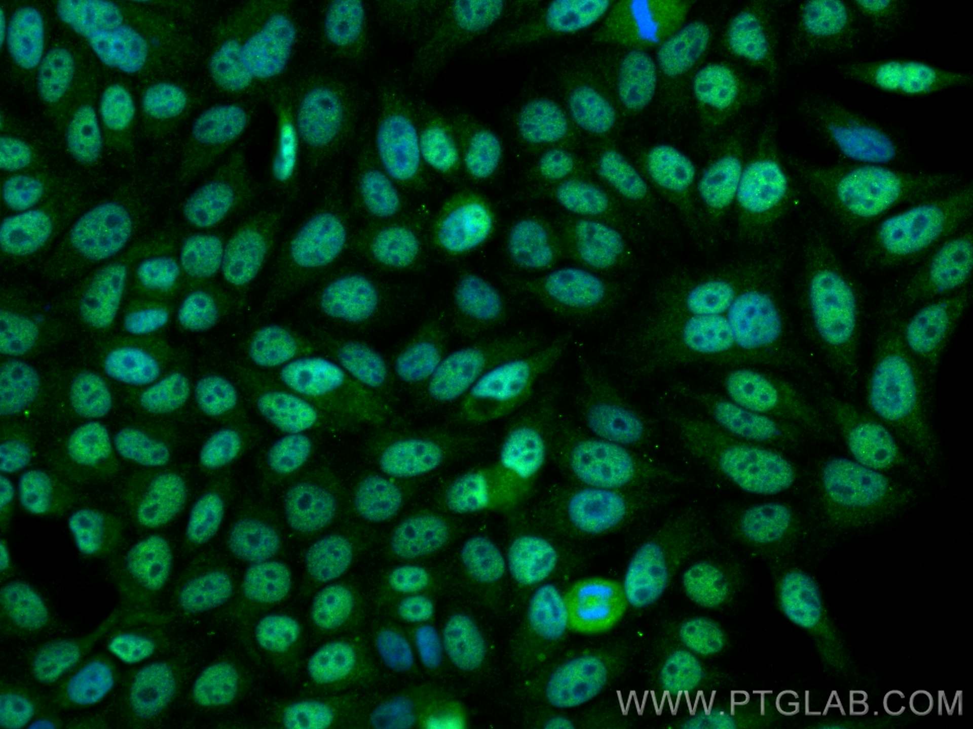 IF Staining of HepG2 using 16511-1-AP