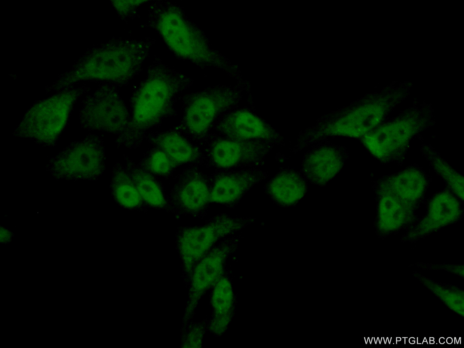 IF Staining of HepG2 using 16511-1-AP