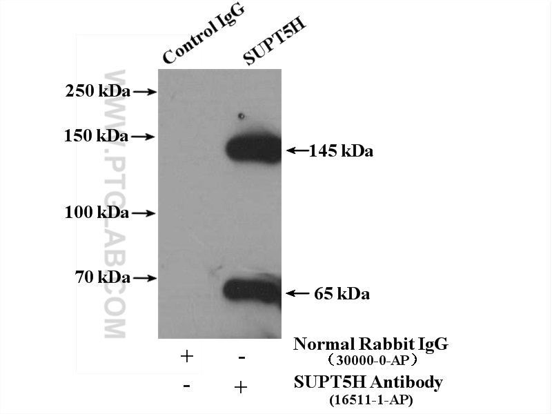 IP experiment of HeLa using 16511-1-AP