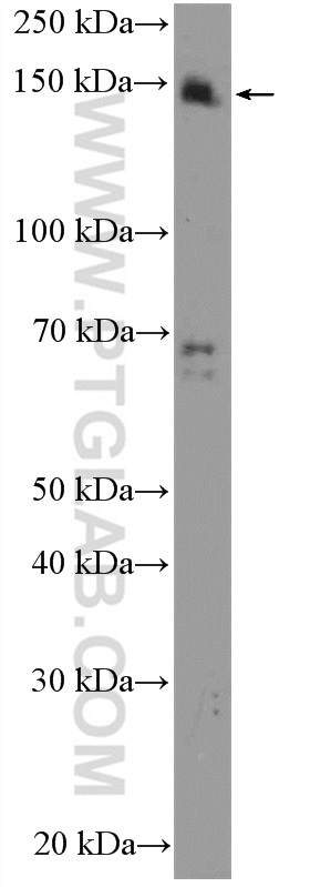 WB analysis of HeLa using 16511-1-AP