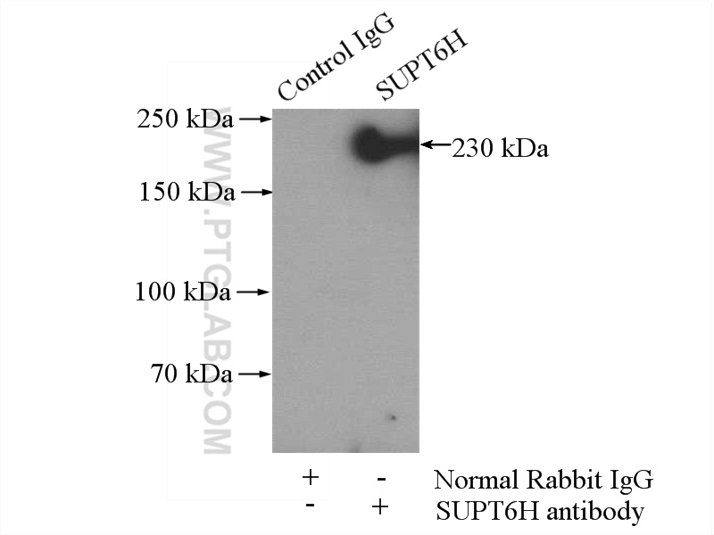 IP experiment of HEK-293 using 23073-1-AP