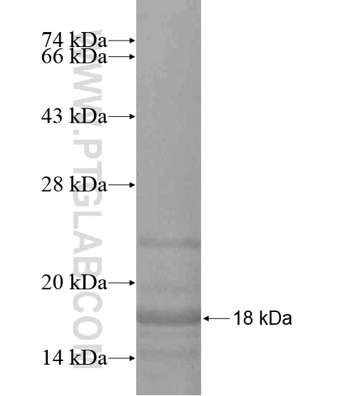 SUPT6H fusion protein Ag19492 SDS-PAGE SUPT6H fusion protein Ag19492 SDS-PAGE