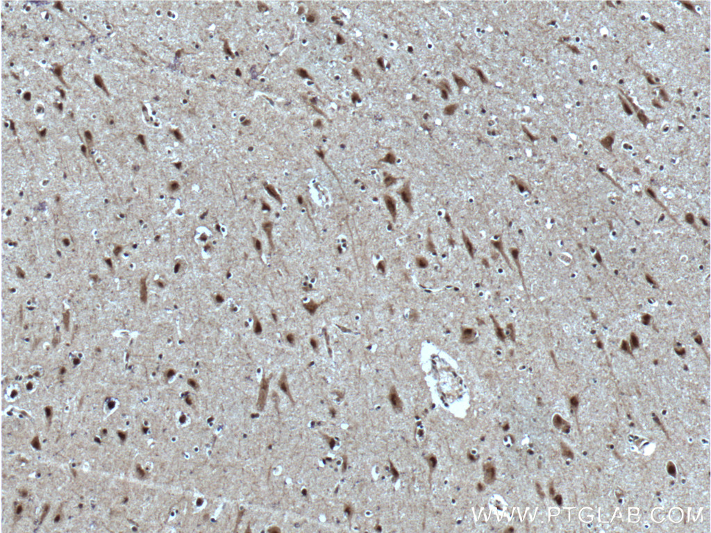 IHC staining of human brain using 25606-1-AP