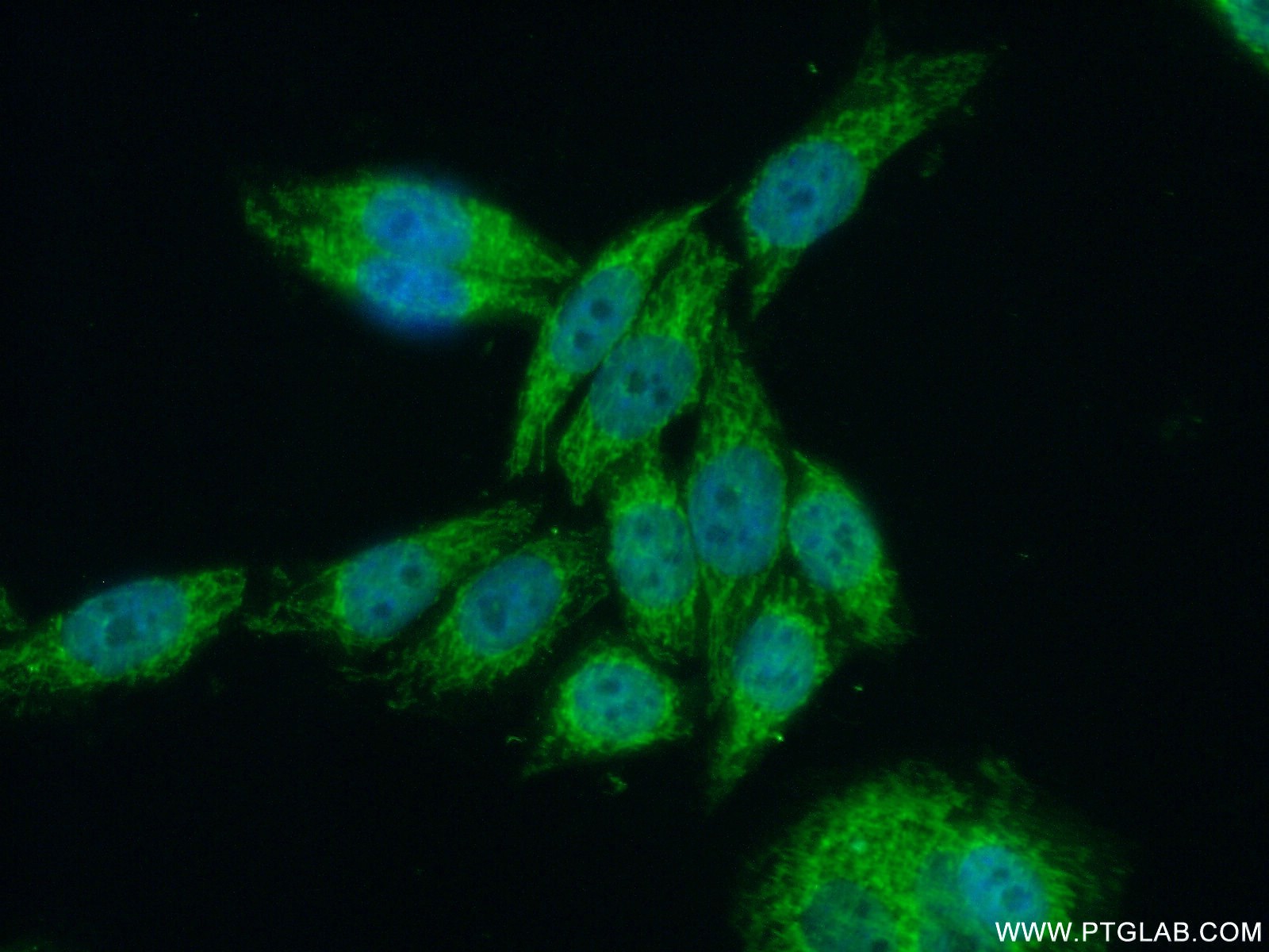 IF Staining of HeLa using 12826-1-AP