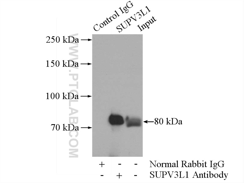 IP experiment of HeLa using 12826-1-AP