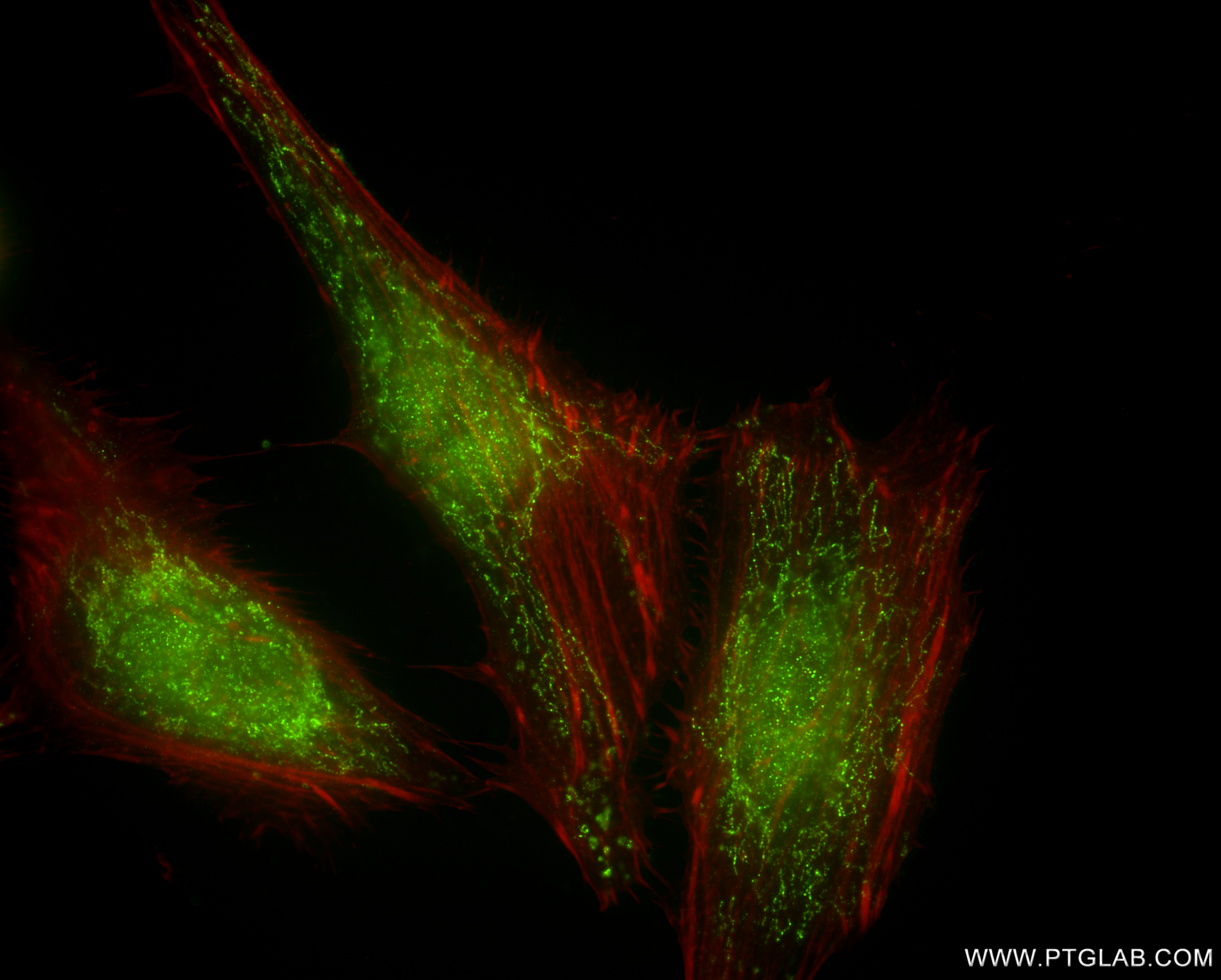 IF Staining of HeLa using 86706-1-RR (same clone as 86706-1-PBS)