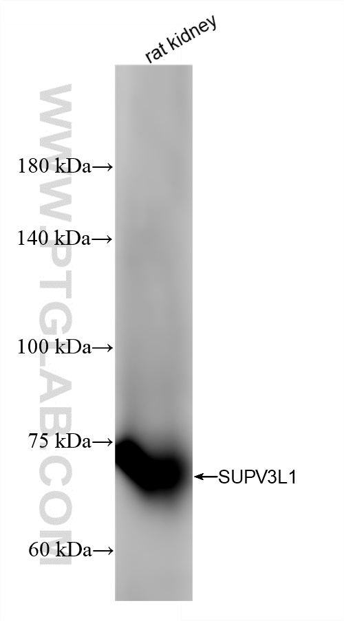 WB analysis of rat kidney using 86706-1-RR (same clone as 86706-1-PBS)