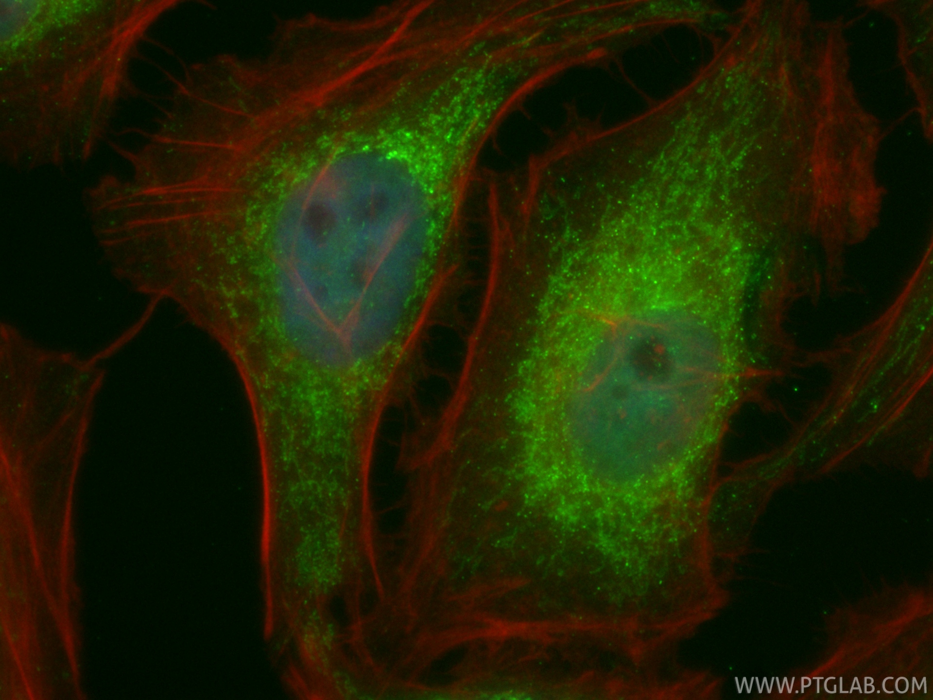 IF Staining of HeLa using CL488-86706