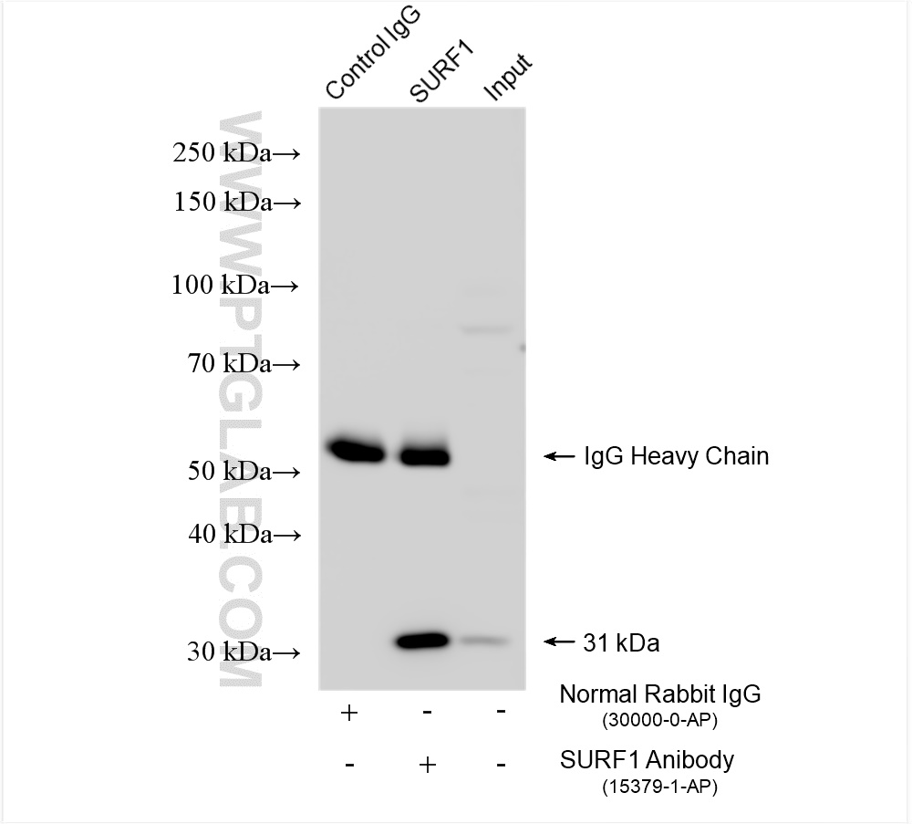 IP experiment of HeLa using 15379-1-AP