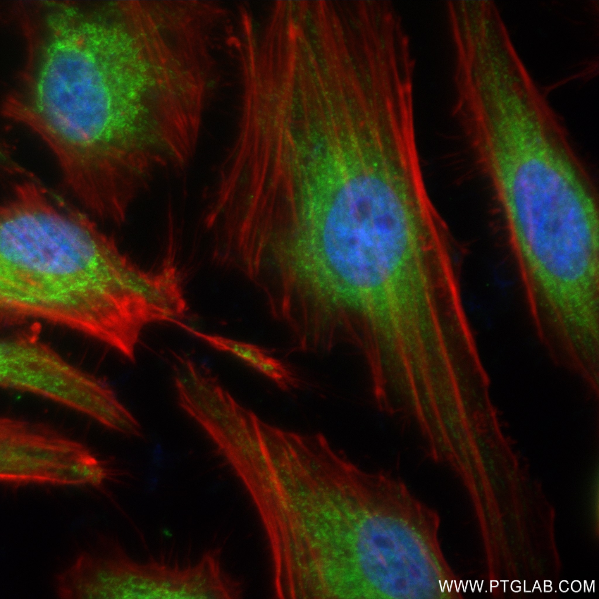 IF Staining of HeLa using 83052-5-RR (same clone as 83052-5-PBS)