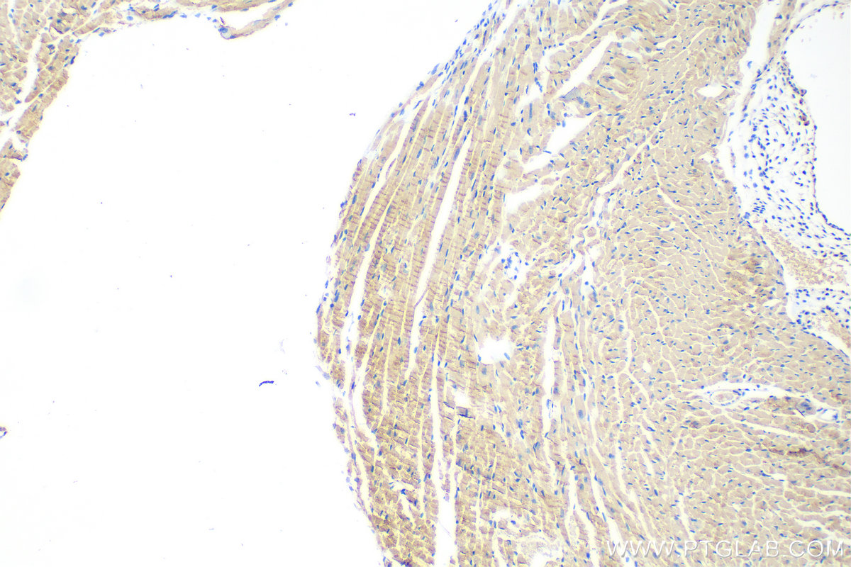 IHC staining of mouse heart using 83052-5-RR (same clone as 83052-5-PBS)
