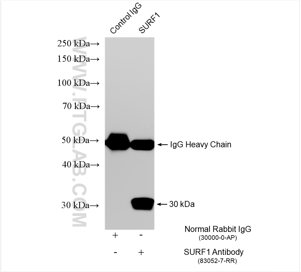 IP experiment of HeLa using 83052-7-RR