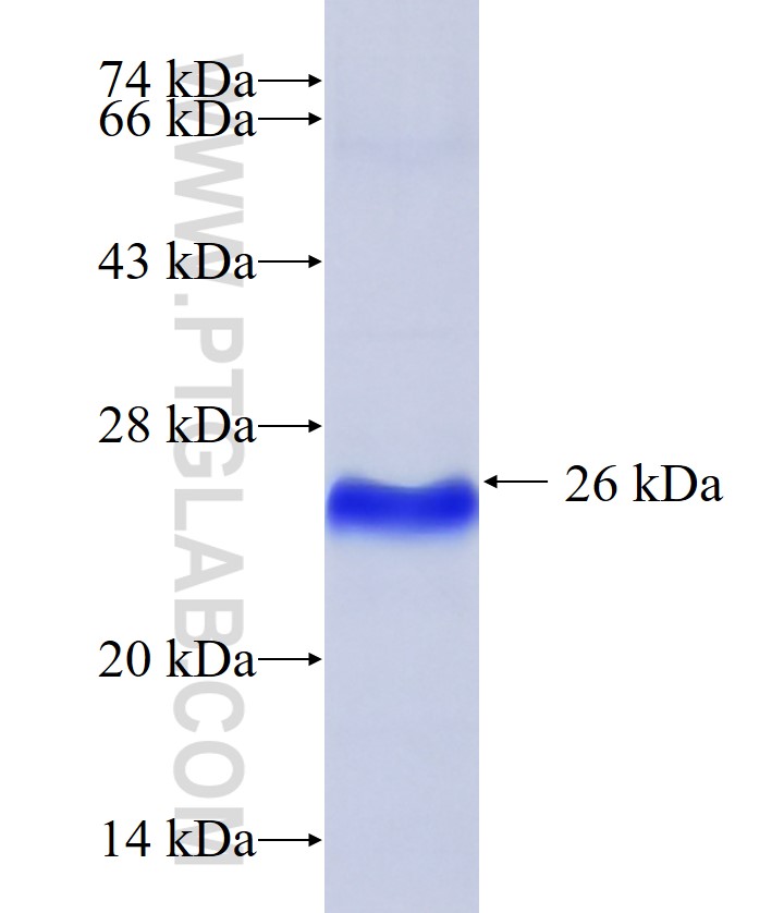 SURVIVIN fusion protein Ag20958 SDS-PAGE