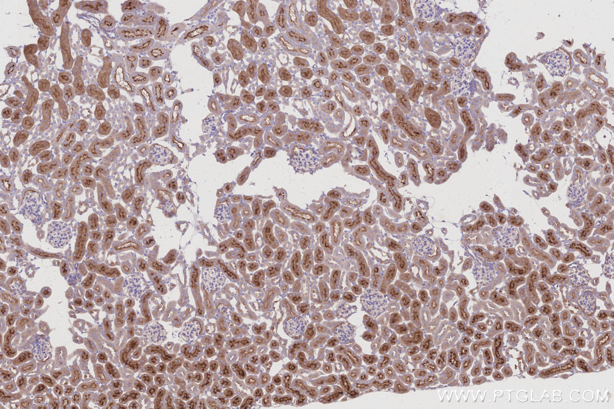 IHC staining of mouse kidney using 30711-1-AP IHC staining of mouse kidney using 30711-1-AP