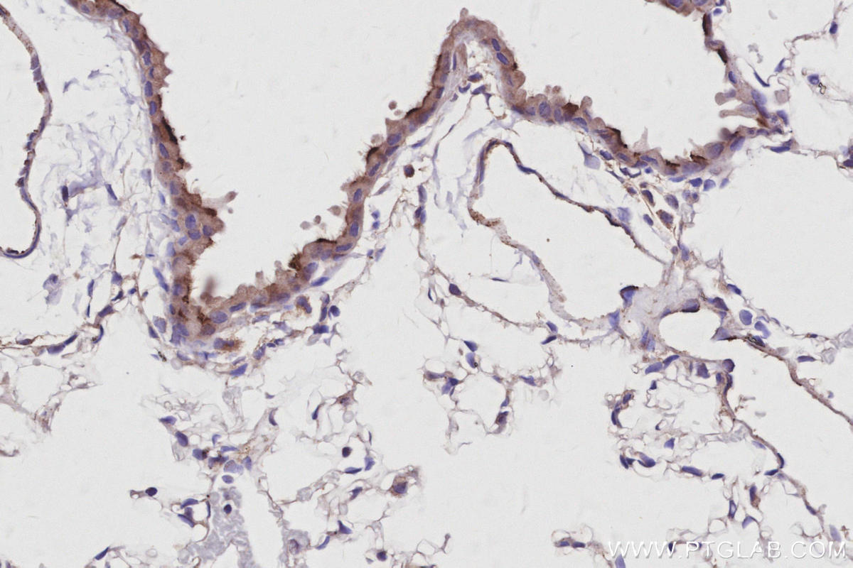 IHC staining of mouse lung using 30711-1-AP IHC staining of mouse lung using 30711-1-AP