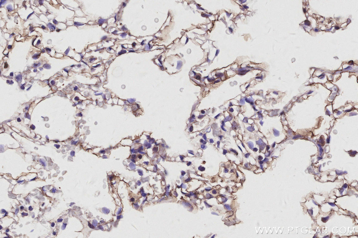 IHC staining of rat lung using 30711-1-AP IHC staining of rat lung using 30711-1-AP