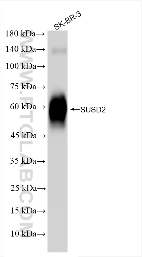 WB analysis of SK-BR-3 using 84852-4-RR (same clone as 84852-4-PBS)