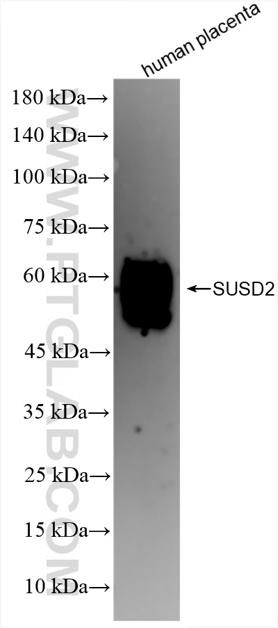WB analysis of human placenta using 84852-4-RR (same clone as 84852-4-PBS)