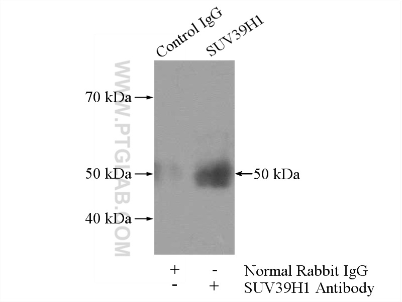 IP experiment of HeLa using 10574-1-AP