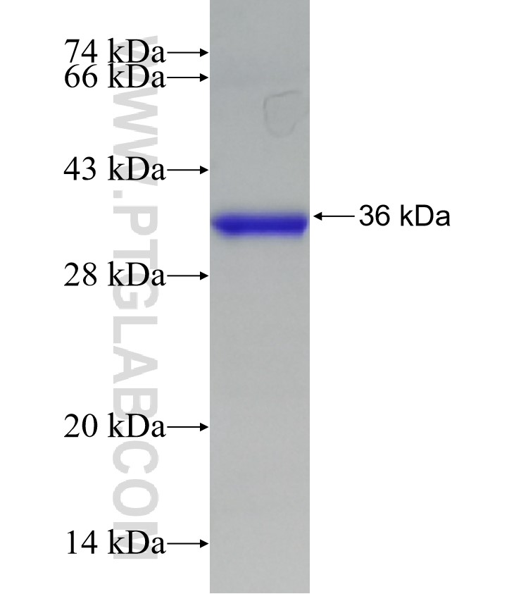 SUV39H1 fusion protein Ag30284 SDS-PAGE