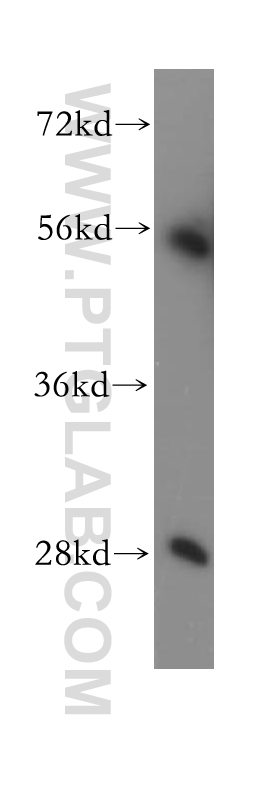 WB analysis of HEK-293 using 11338-1-AP