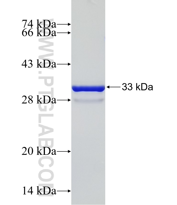 SUV39H2 fusion protein Ag31589 SDS-PAGE SUV39H2 fusion protein Ag31589 SDS-PAGE