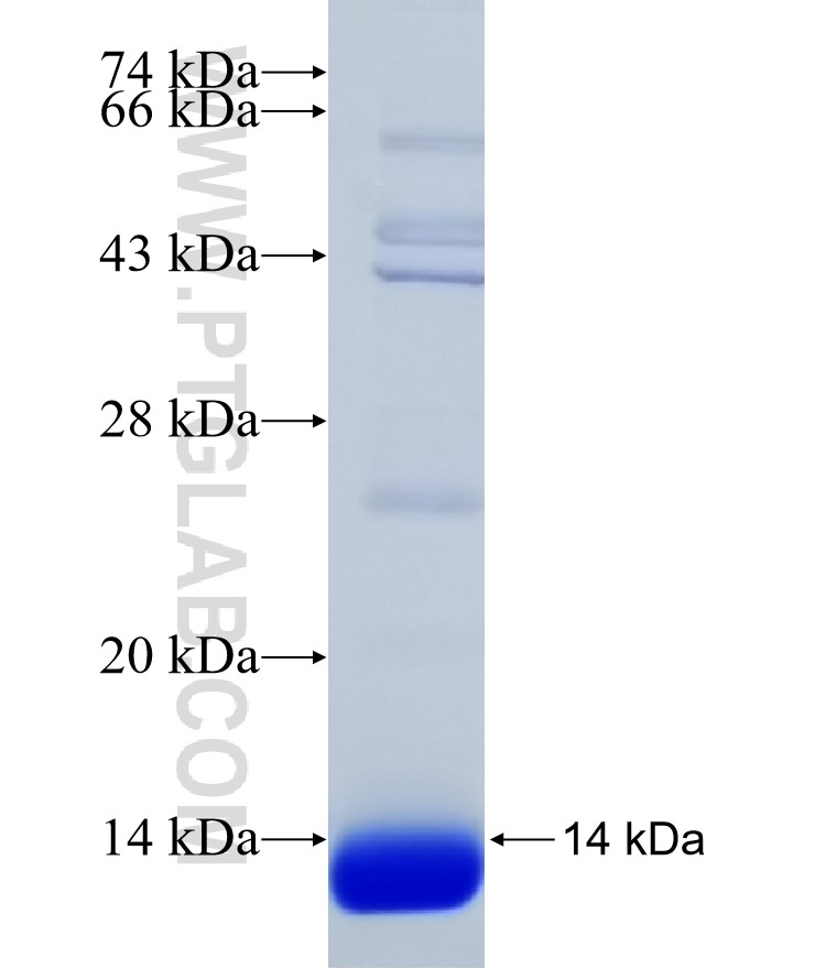 SUV39H2 fusion protein Ag31601 SDS-PAGE