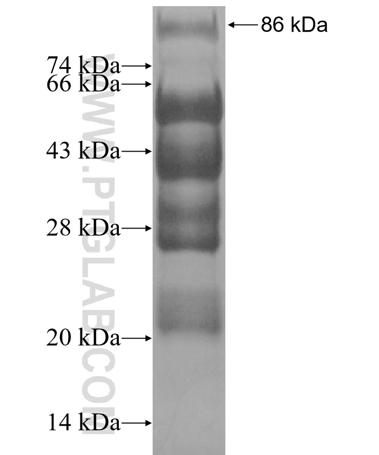 SUV420H1 fusion protein Ag11194 SDS-PAGE