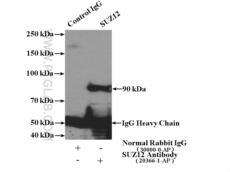 IP experiment of HeLa using 20366-1-AP