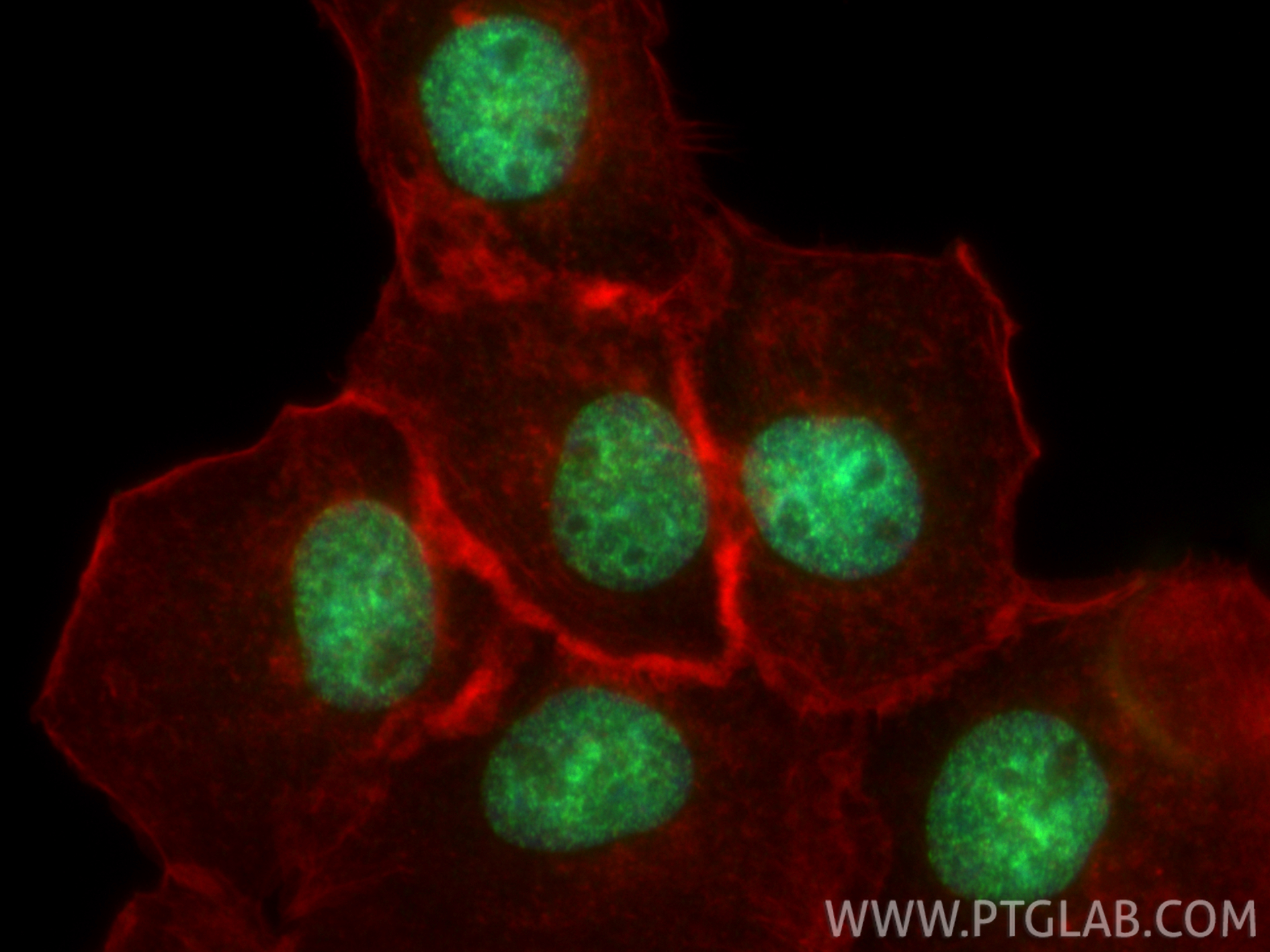 IF Staining of A431 using 84895-3-RR IF Staining of A431 using 84895-3-RR