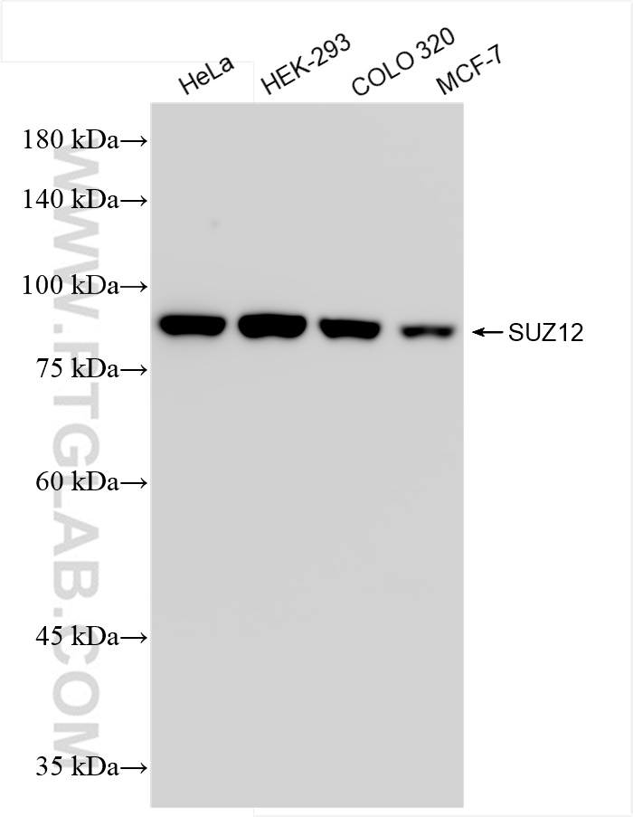 WB analysis using 84895-3-RR (same clone as 84895-3-PBS)