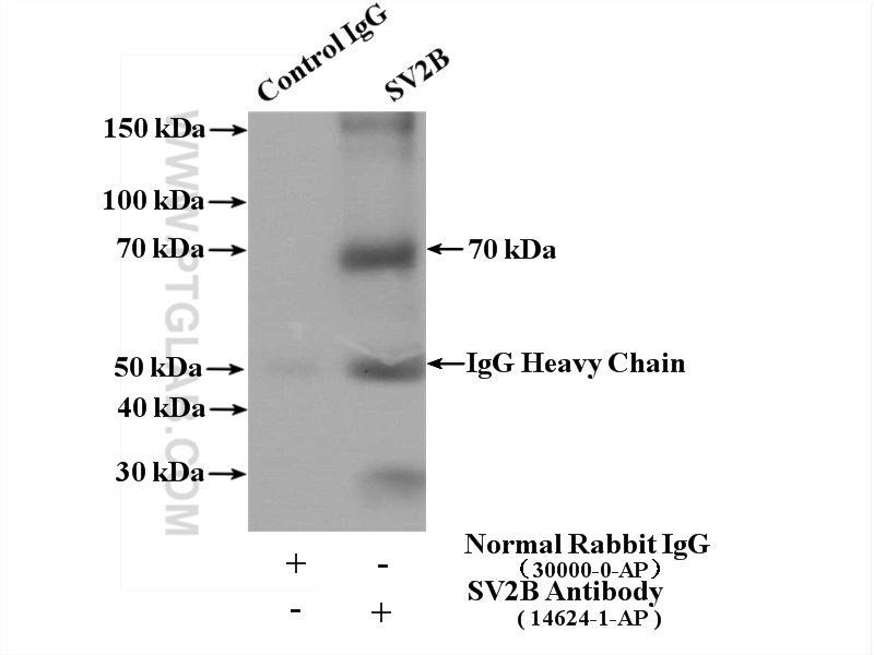 IP experiment of mouse brain using 14624-1-AP