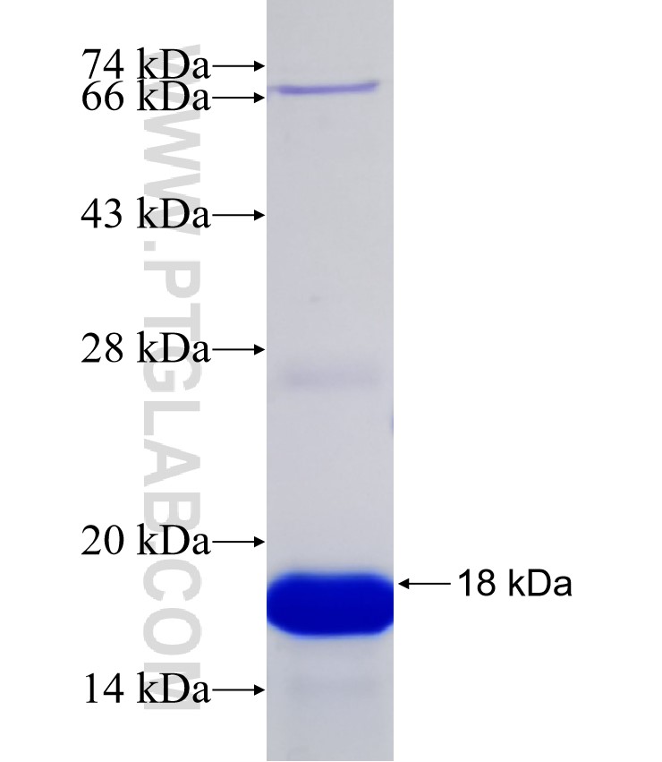 SV2C fusion protein Ag32332 SDS-PAGE SV2C fusion protein Ag32332 SDS-PAGE