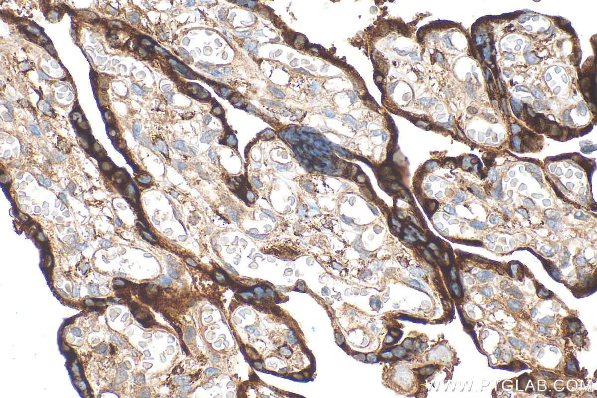 Immunohistochemical analysis of paraffin-embedded human placenta tissue slide using 31030-1-AP (SVEP1 antibody) at dilution of 1:1000 (under 40x lens). Heat mediated antigen retrieval with Tris-EDTA buffer (pH 9.0). IHC staining of human placenta using 31030-1-AP
