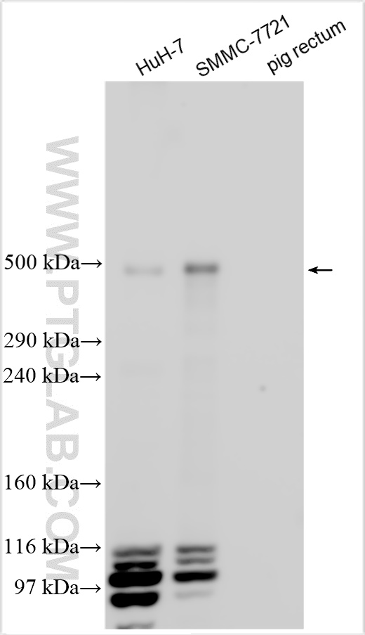 WB analysis using 31030-1-AP