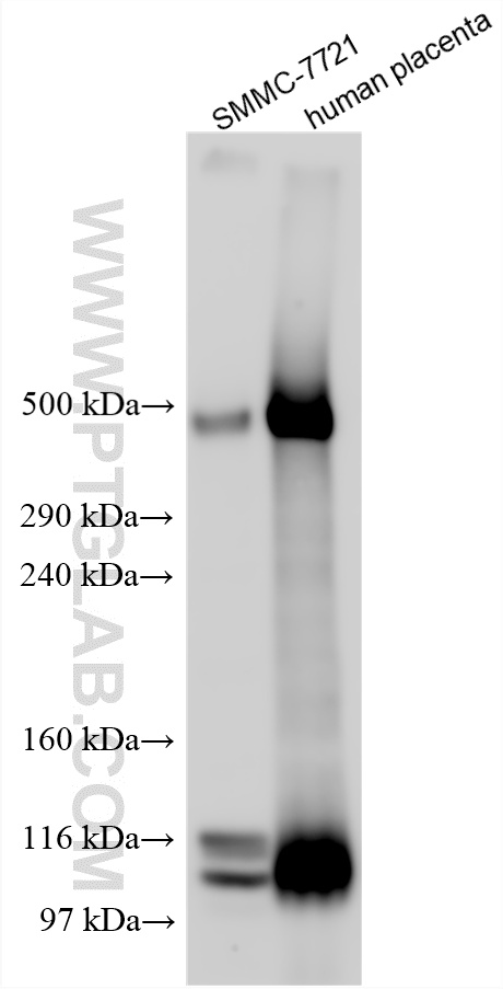 Various lysates were subjected to Tris-Acetate gel system followed by western blot with 31030-1-AP (SVEP1 antibody) at dilution of 1:600 incubated at room temperature for 1.5 hours. WB analysis using 31030-1-AP