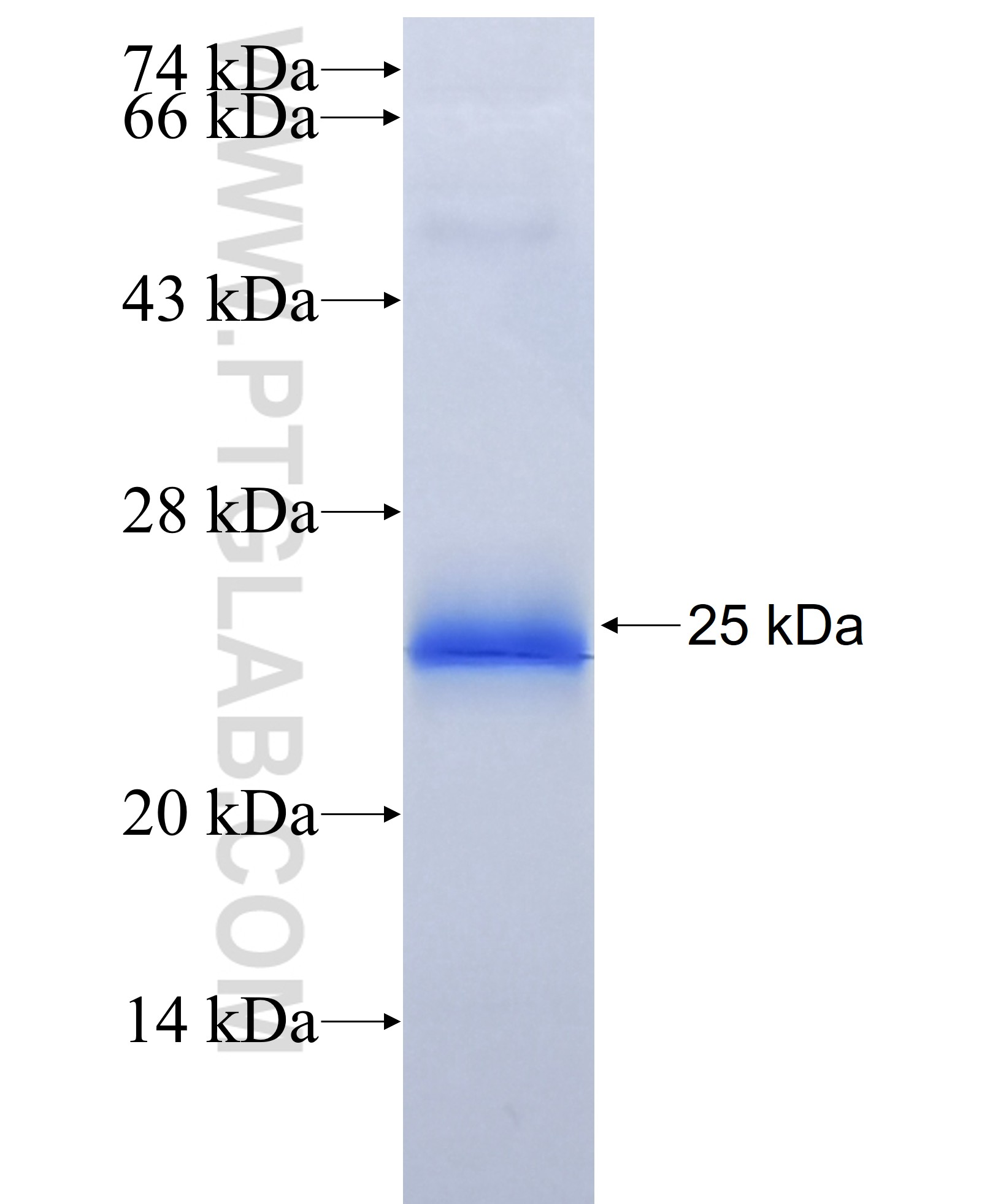 SVEP1 fusion protein Ag34337 SDS-PAGE SVEP1 fusion protein Ag34337 SDS-PAGE