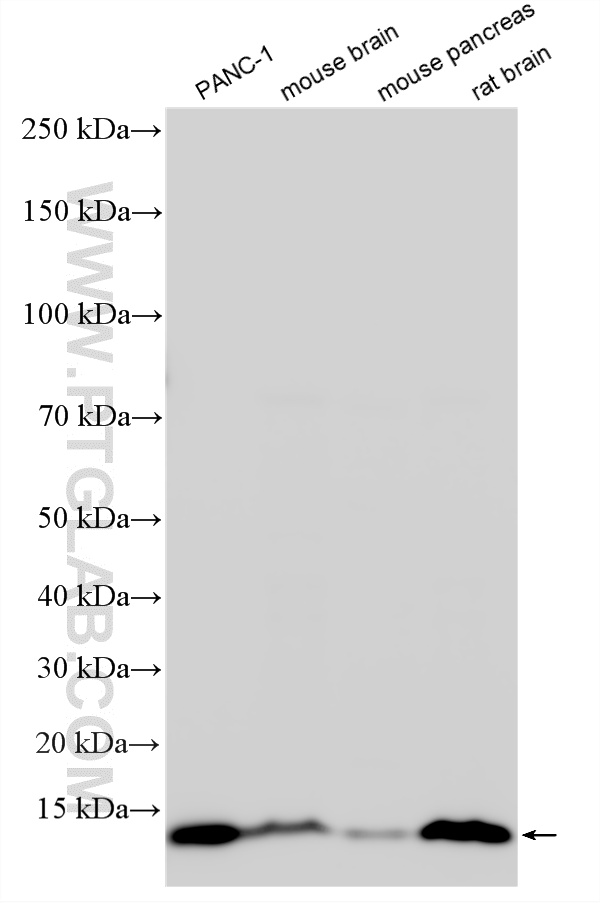 WB analysis using 32511-1-AP (same clone as 32511-1-PBS) WB analysis using 32511-1-AP (same clone as 32511-1-PBS)