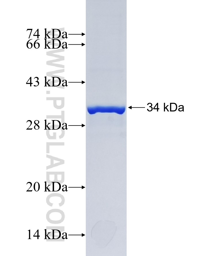 SVIP fusion protein Ag36618 SDS-PAGE
