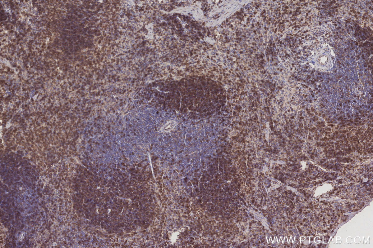 IHC staining of mouse spleen using 31042-1-AP IHC staining of mouse spleen using 31042-1-AP