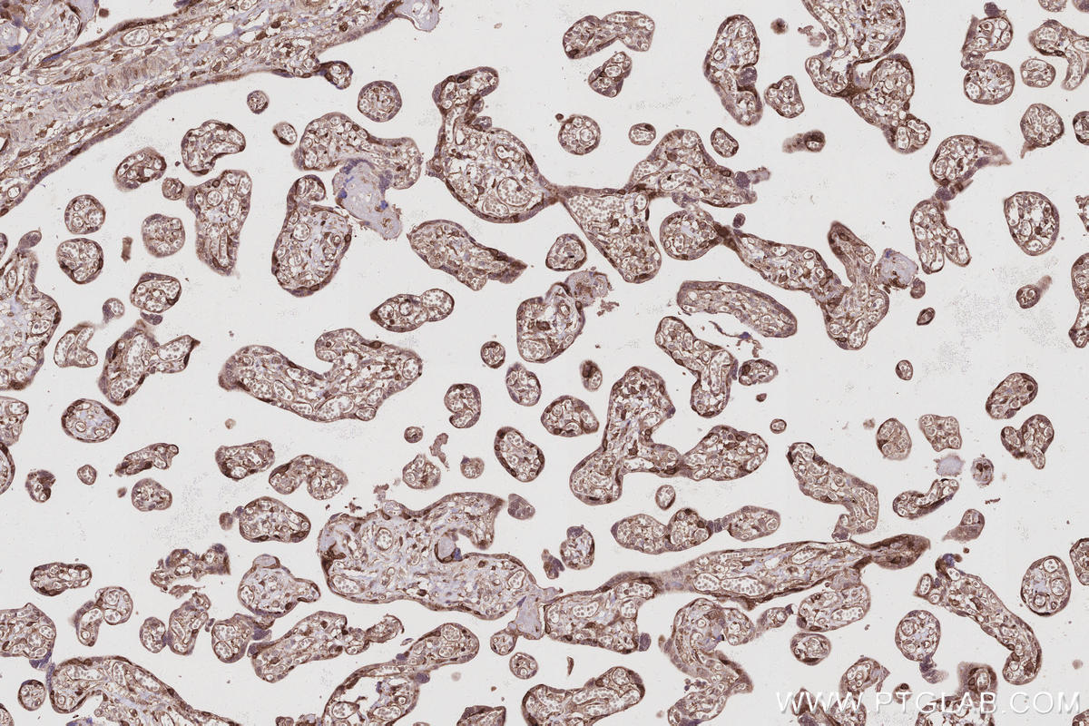 IHC staining of human placenta using 31042-1-AP IHC staining of human placenta using 31042-1-AP