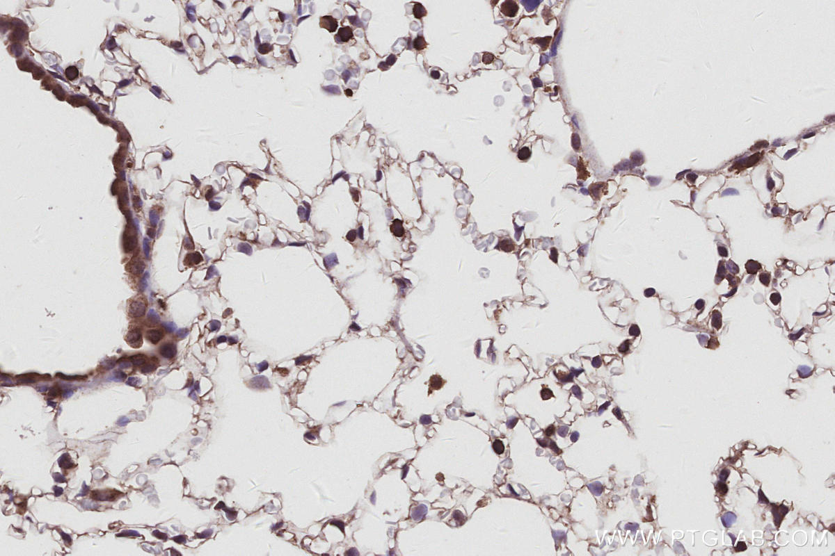 IHC staining of mouse lung using 31042-1-AP IHC staining of mouse lung using 31042-1-AP