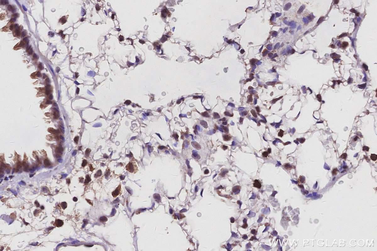 IHC staining of rat lung using 31042-1-AP IHC staining of rat lung using 31042-1-AP