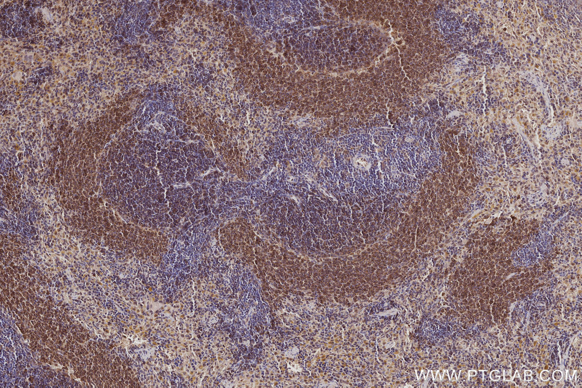 IHC staining of rat spleen using 31042-1-AP IHC staining of rat spleen using 31042-1-AP
