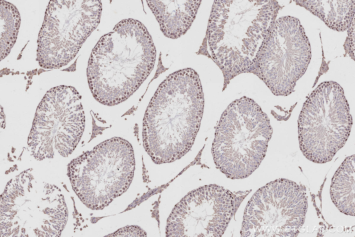 IHC staining of rat testis using 31042-1-AP IHC staining of rat testis using 31042-1-AP