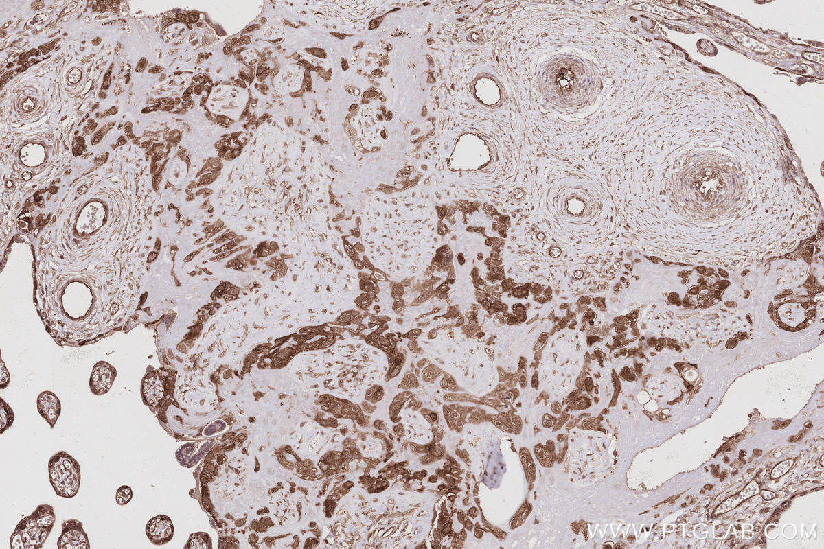 IHC staining of human placenta using 31042-1-AP IHC staining of human placenta using 31042-1-AP