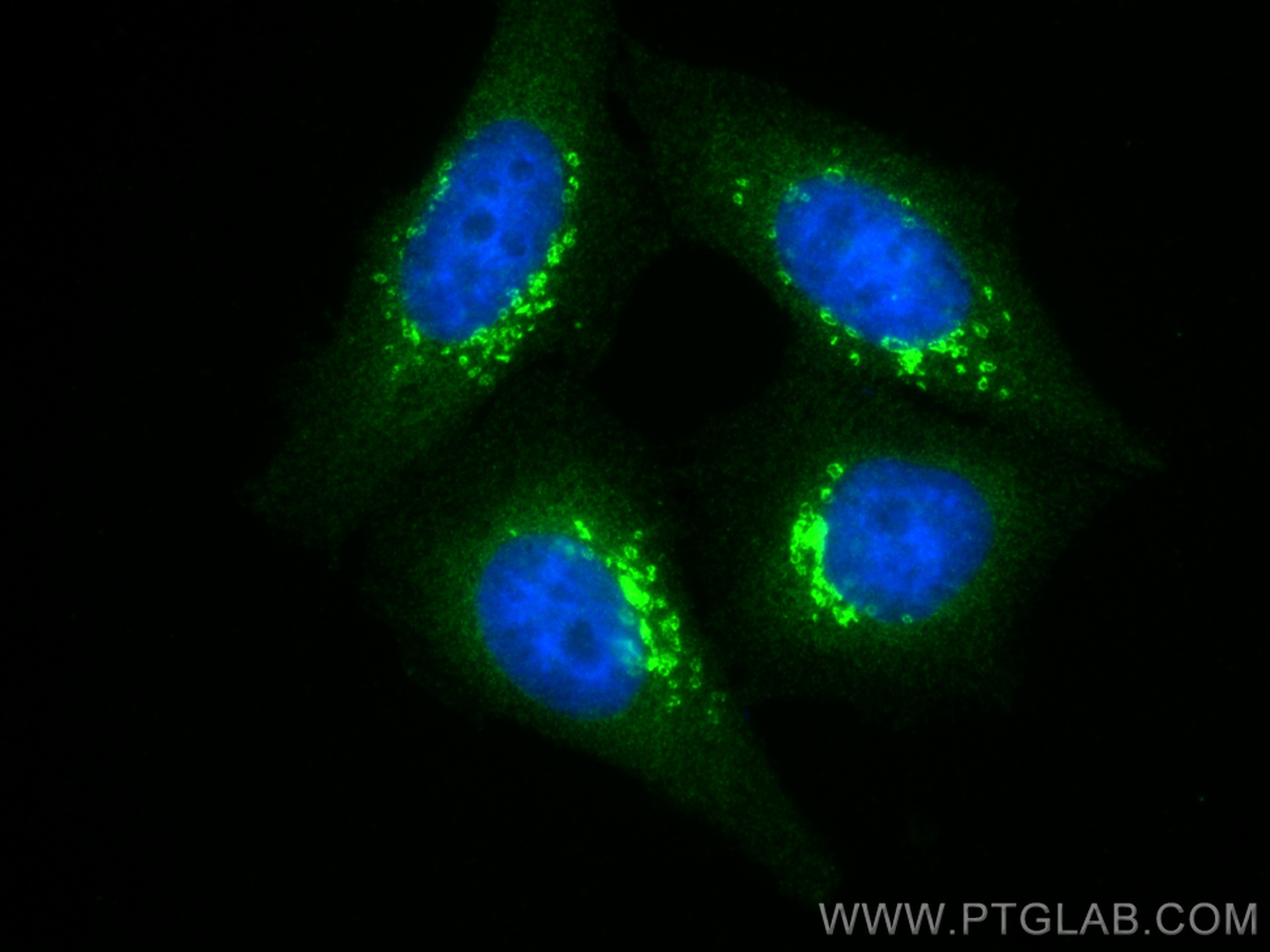 IF Staining of HepG2 using 16272-1-AP