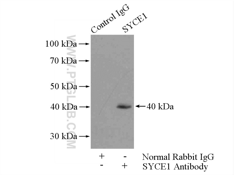 IP experiment of mouse testis using 11063-1-AP