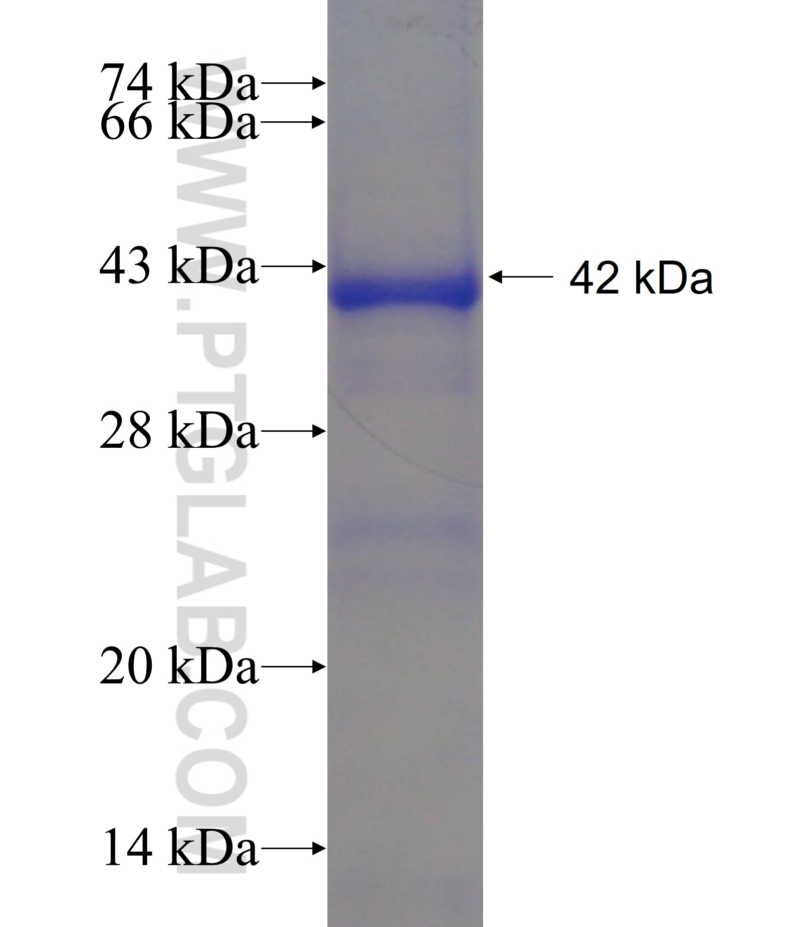 SYCE1 fusion protein Ag11410 SDS-PAGE SYCE1 fusion protein Ag11410 SDS-PAGE