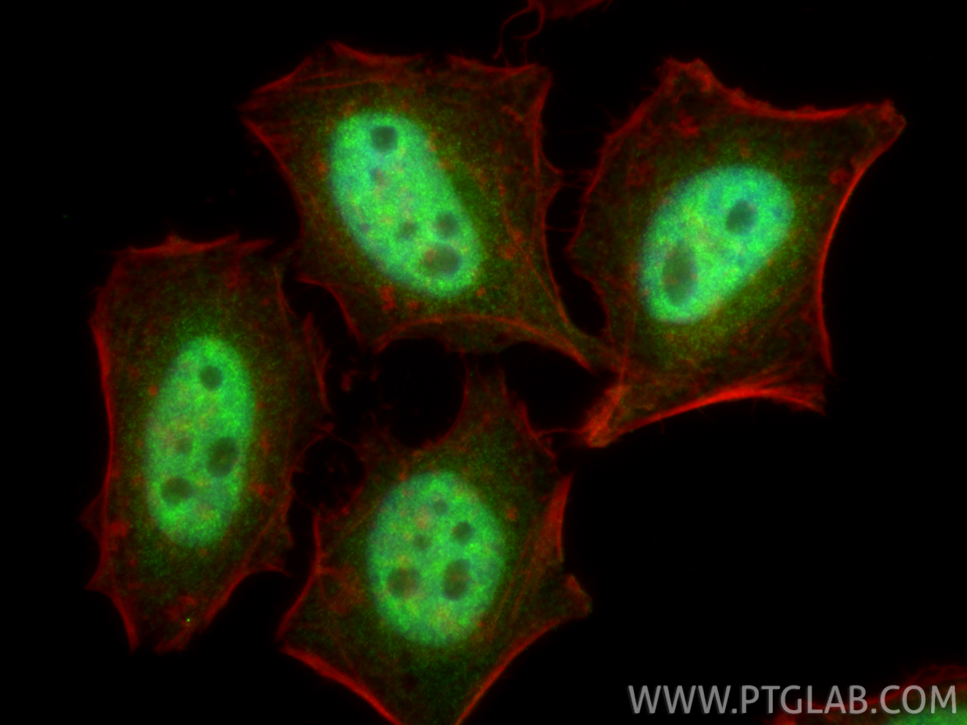 IF Staining of HeLa using 16859-1-AP IF Staining of HeLa using 16859-1-AP